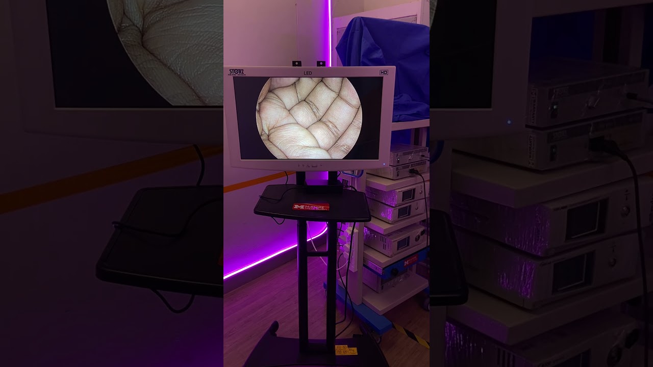 Karl Storz Image 1 HUB HD with LED Nova 150