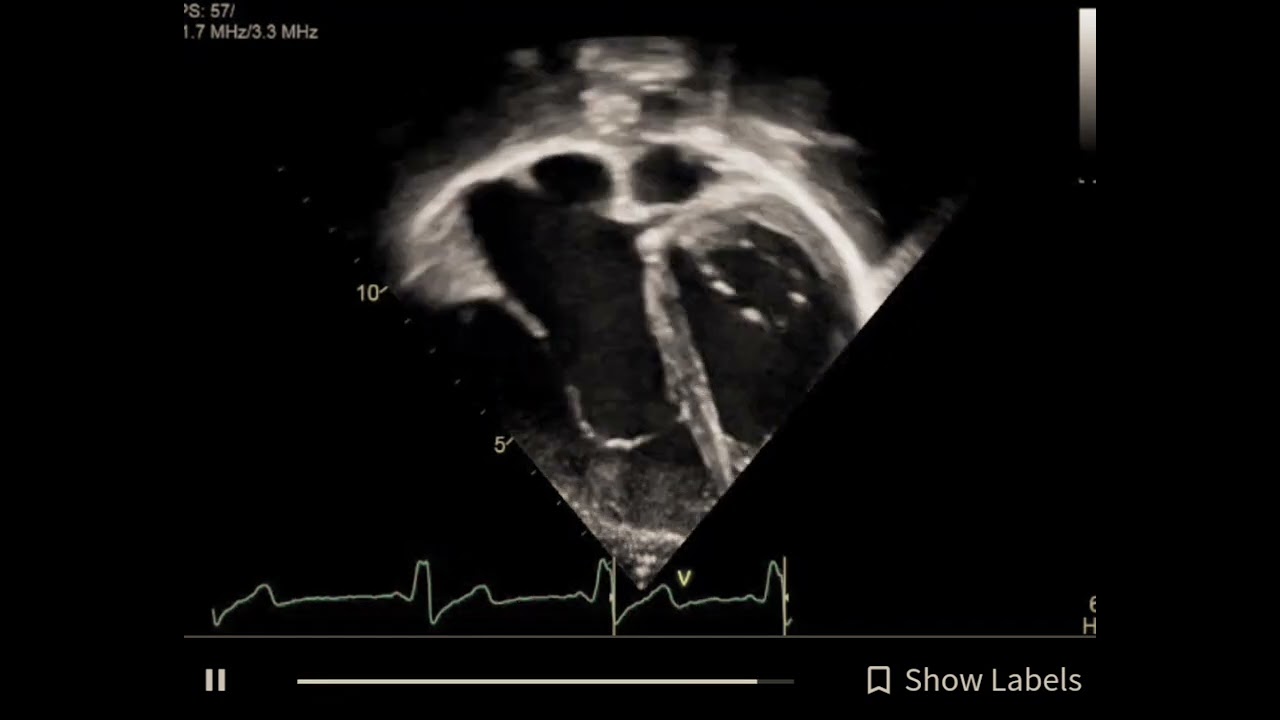 Carlos Mario Balcazar Ochoa-7