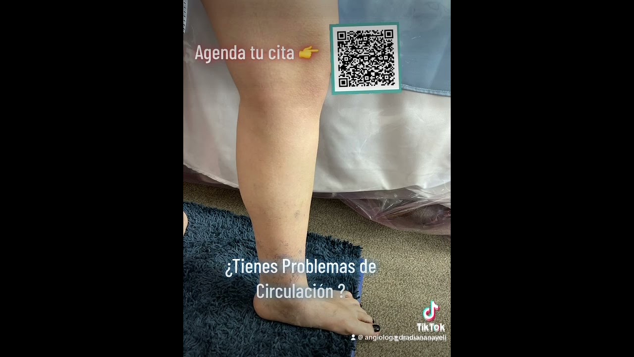 Diana Nayeli Hernández Jiménez-67