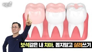 [메디텔] 보석같은 내치아, 뽑지말고 살려쓰기