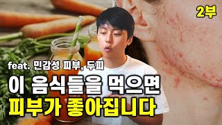 피부, 두피에 좋은 음식 & 보조제 (ft. 여드름, 모낭염, 지루성두피염)ㅣ2부