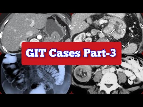 Radiology Viva Cases # 336-342 | Gastrointestinal (GIT) Cases Part-3 #medical #radiology #ultrasound