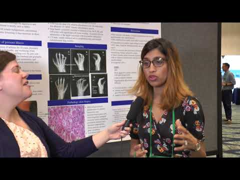 Dr. Sheetal Patel at RWCS 2018, Poster Presentation