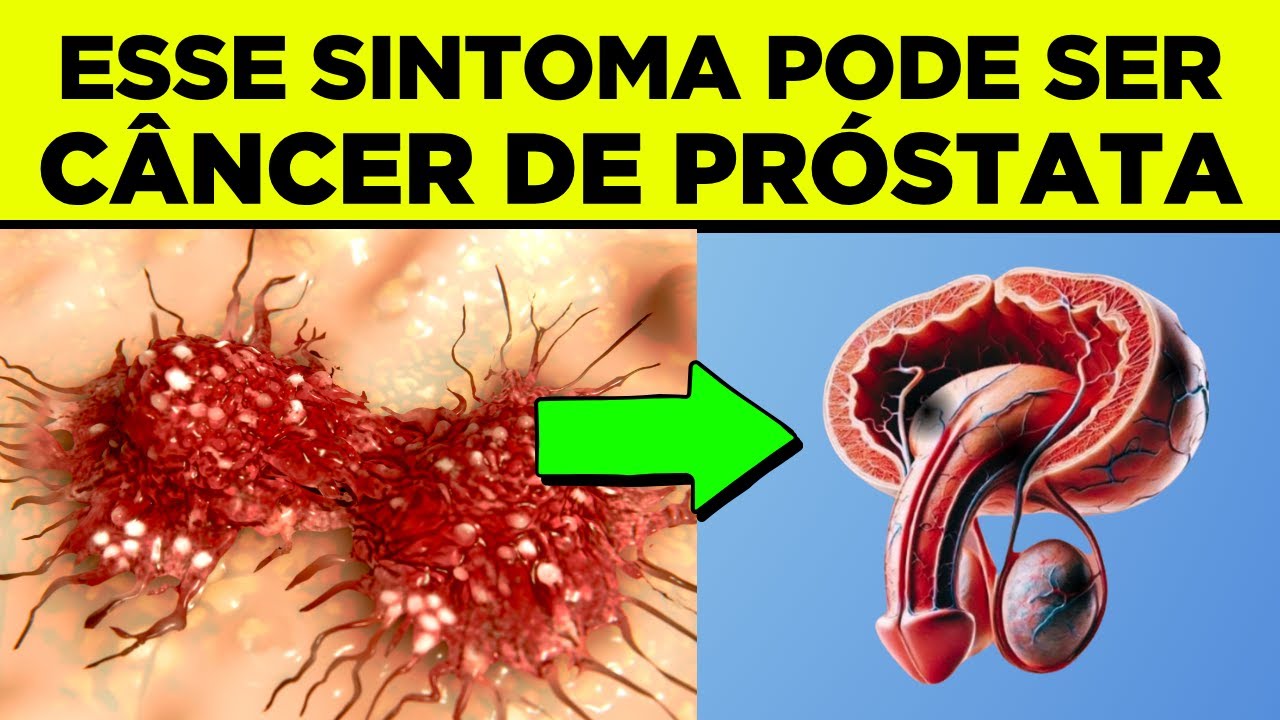 CÂNCER DE PRÓSTATA: Primeiro SINAIS e SINTOMAS - NÃO IGNORE!