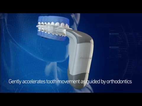 download lagu mp3 mp4 Orthodontist Victoria Tx, download lagu Orthodontist Victoria Tx gratis, unduh video klip Orthodontist Victoria Tx