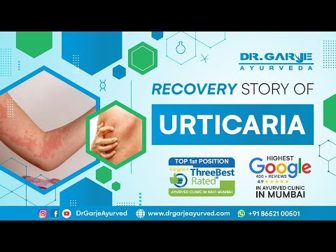  Panchakarma Patient Testimonial - Review 7
