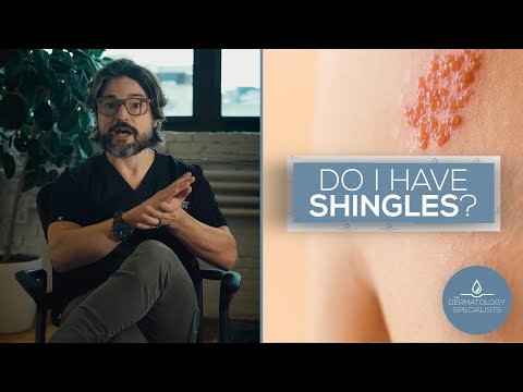 How to Identify Shingles
