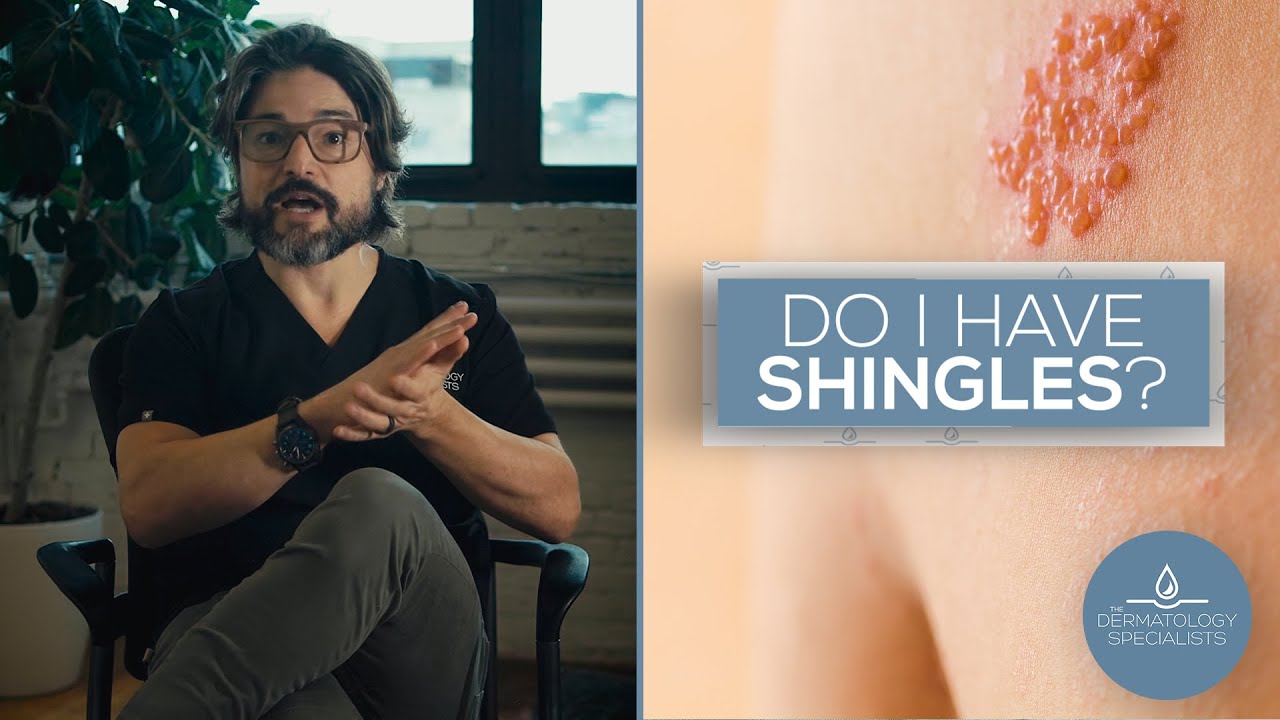 How to Identify Shingles