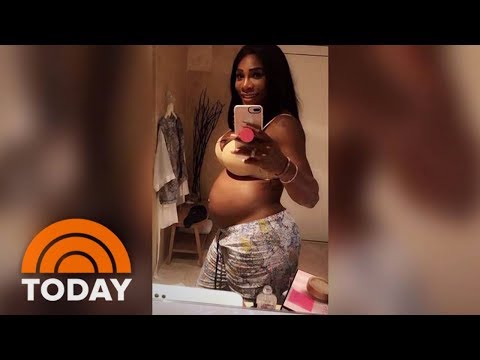 download lagu mp3 mp4 Serena Williams Baby Photo, download lagu Serena Williams Baby Photo gratis, unduh video klip Serena Williams Baby Photo