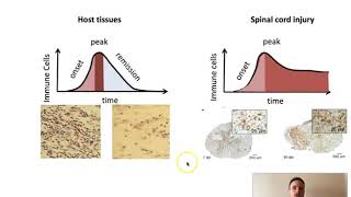 Lesiones, degeneración, regeneración y neurogénesis del sistema nervioso (Parte 1)