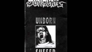 Suffocate - Unborn Suffer
