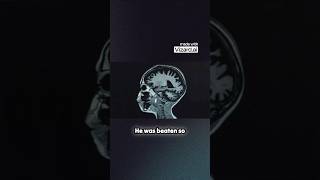 Download lagu This is the worst way to D!E! mp3 Download lagu This is the worst way to D!E! mp3