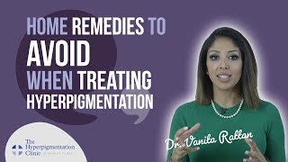 How to Treat Hyperpigmentation - Home Remedies - DO THEY WORK?