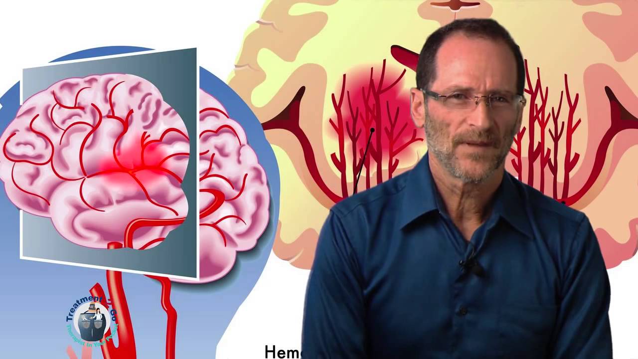 Health Advice - Talking Head