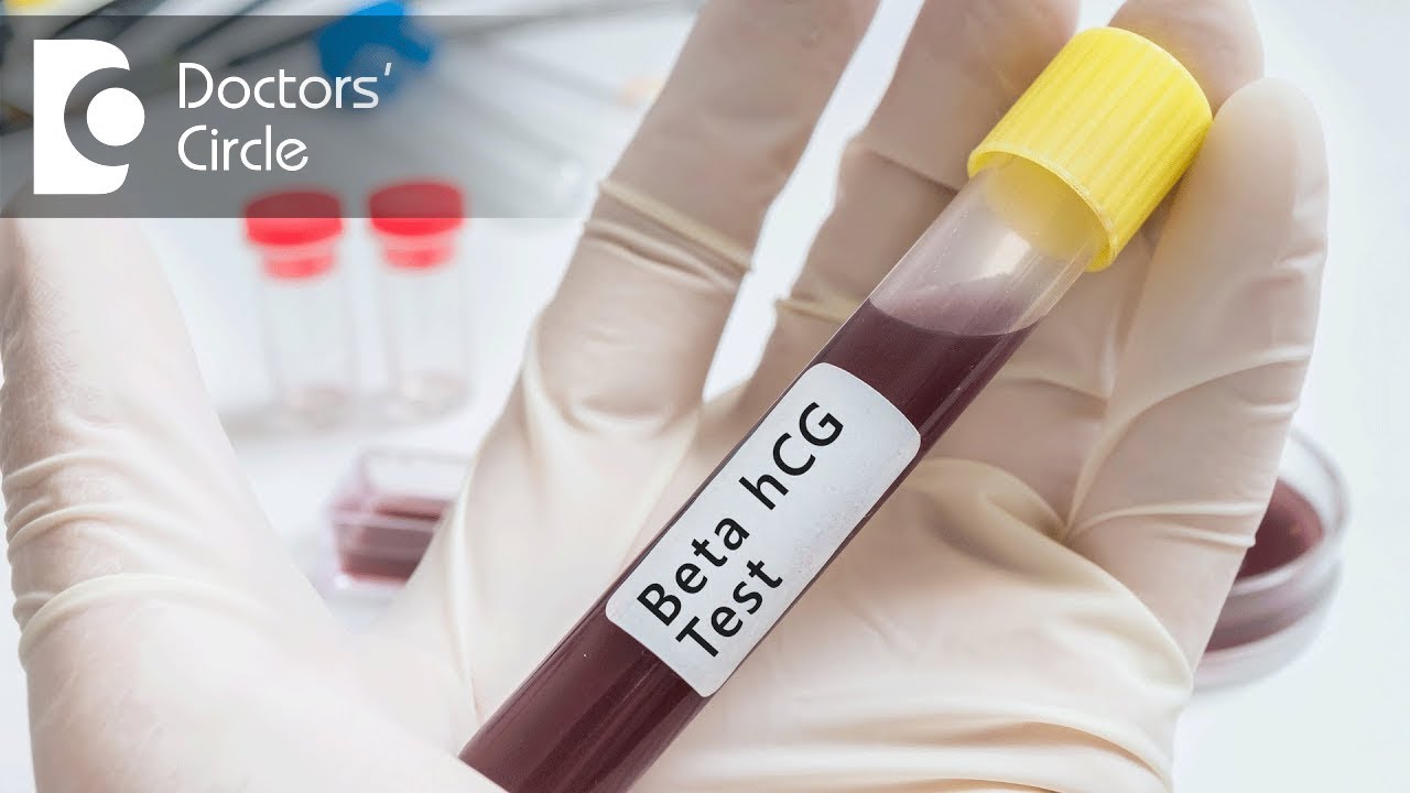 What is the ideal level of Beta hcG for a positive Pregnancy-Dr. Geeta Komar
