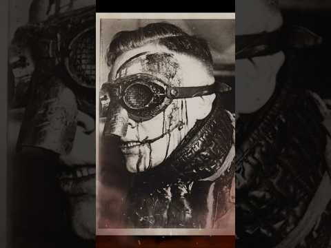 Why do so many German Officers have facial scars? #history #ww2