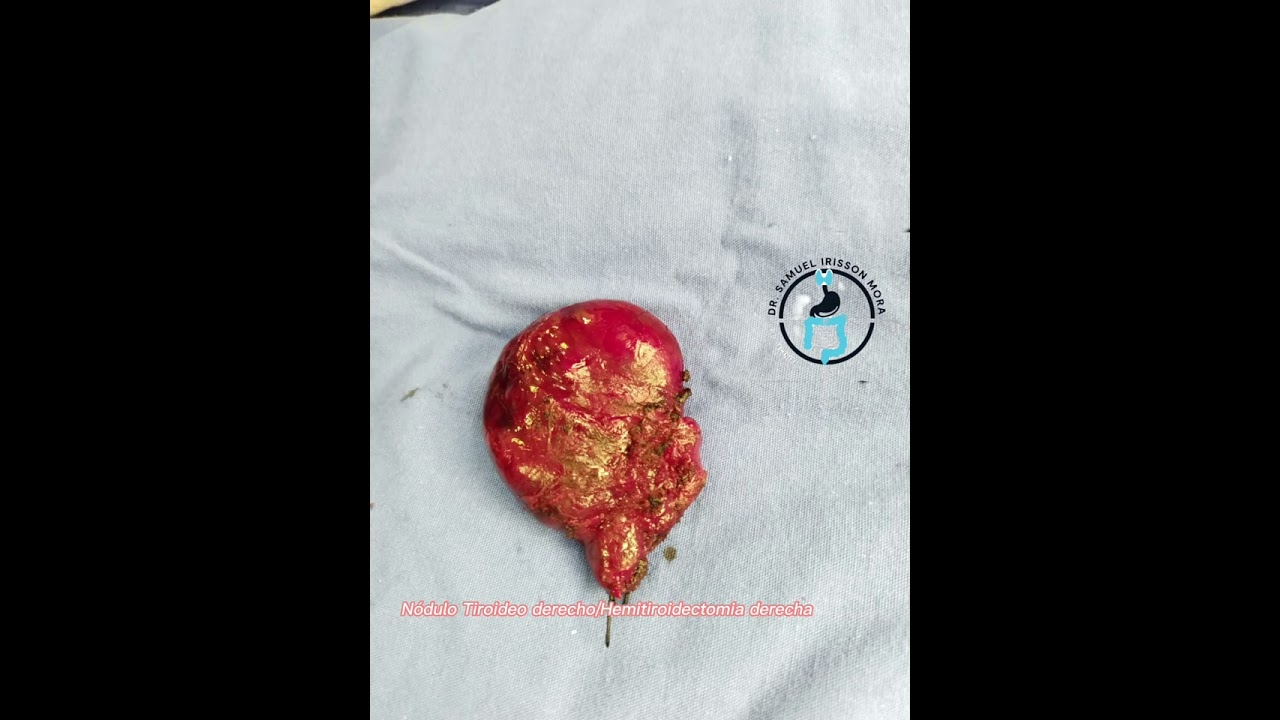 Samuel Irisson Mora-14