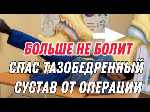 Тазобедренный сустав больше не болит после этого упражнения 