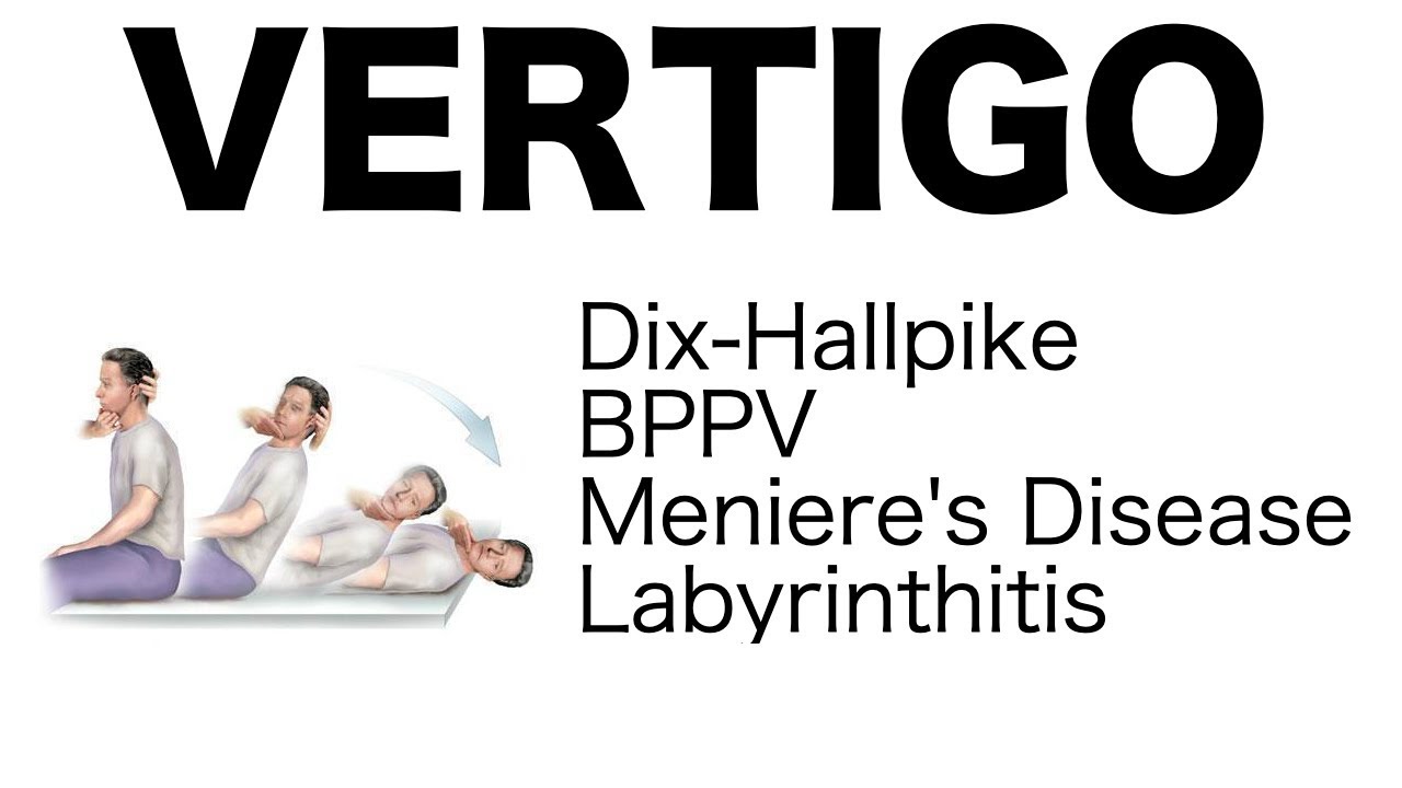 Vertigo (Different Types, Dix-Hallpike Maneuver, Treatment)