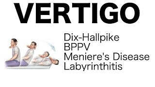 Vertigo (Different Types, Dix-Hallpike Maneuver, Treatment)