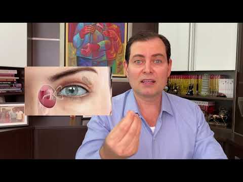 🔺 O Que Causa Lacrimejamento nos Olhos - Dr. Fernando Pacheco Veríssimo