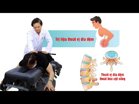 Điều trị thoát vị đĩa đệm không dùng thuốc - Không phẫu thuật