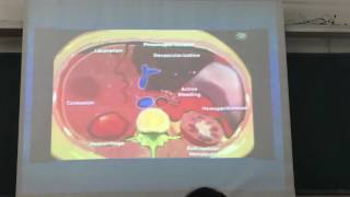 CT BUNG CAP  THAY Phương