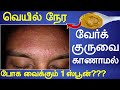 1 ஸ்பூன் தடவினால் போதும் வேர்க்குரு ம�