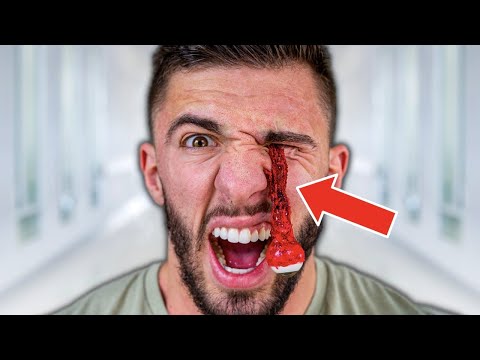 MY EYEBALL FELL OUT!