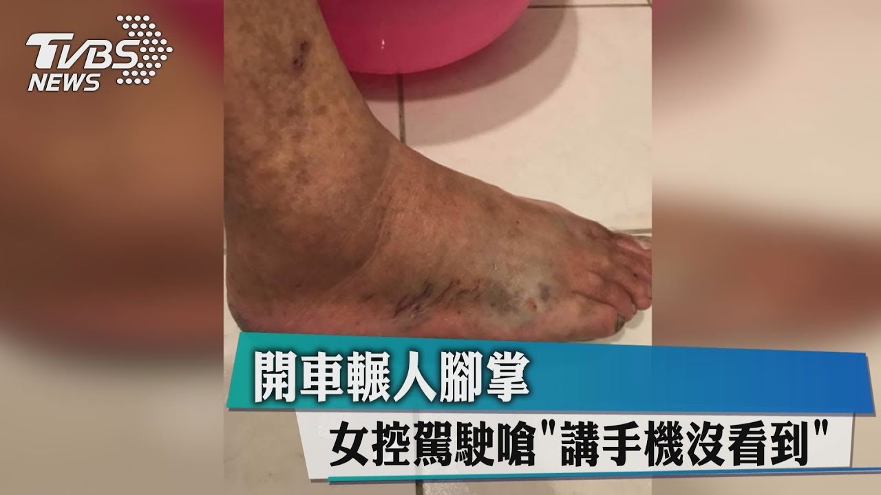 開車輾人腳掌 女控駕駛嗆「講手機沒看到」