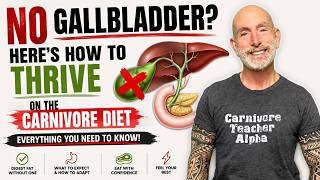 No Gallbladder? Here's How to Thrive on the Carnivore Diet | Everything You Need to Know