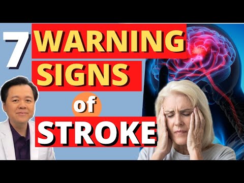7 Warning Signs of Stroke - by Doc Willie Ong