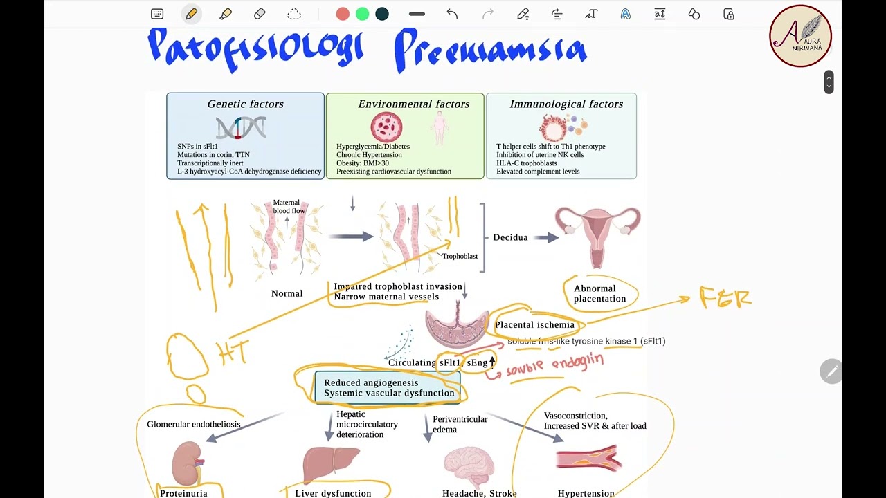 Preeklamsia Hipertensi Dalam Kehamilan - Patofisiologi, Diagnosis, Manajemen Persalinan dan Obat