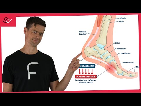 Fußschmerzen loswerden - Mach diese 2 Übungen