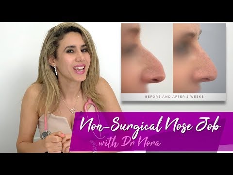 Non-Surgical Nose Job in 15 Minutes | Treatment Case Study and Risks