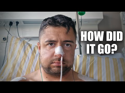 1 Week After My Surgery: Experiences & Recovery