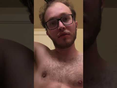 Balding Man 23 Has INSTANT Glow Up