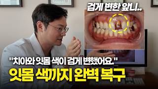 유튜브썸네일