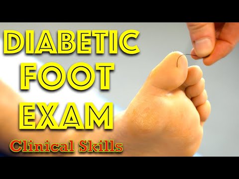 Diabetic Foot Examination - Clinical Skills - Dr Gill
