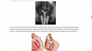 Download lagu Detonorm - Menyumbang kepada pemusnahan sumber semua jenis jangkitan parasit (Malaysia) mp3 Download lagu Detonorm - Menyumbang kepada pemusnahan sumber semua jenis jangkitan parasit (Malaysia) mp3