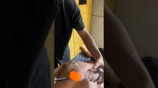 Download lagu Cara Bekam menggunakan api mp3 Download lagu Cara Bekam menggunakan api mp3