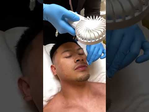 Procell MicroChanneling at Paua Beauty Lounge San Francisco!!!