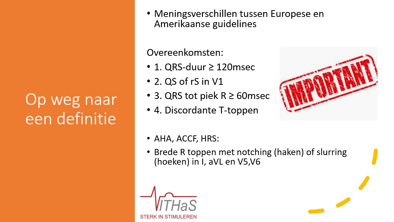 CRT optimalisatie middels het ECG
