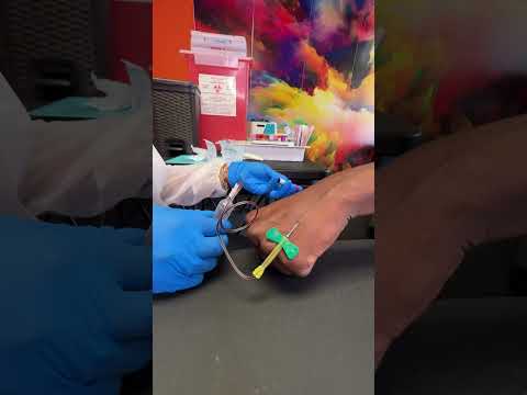 How To Draw Blood From The Hand with a butterfly needle