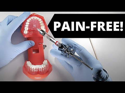 Deliver A Painless Palatal Injection 