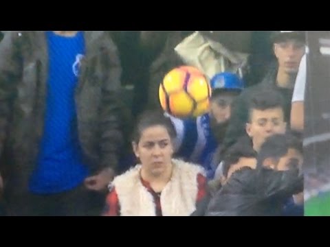 Ball in face during the match
