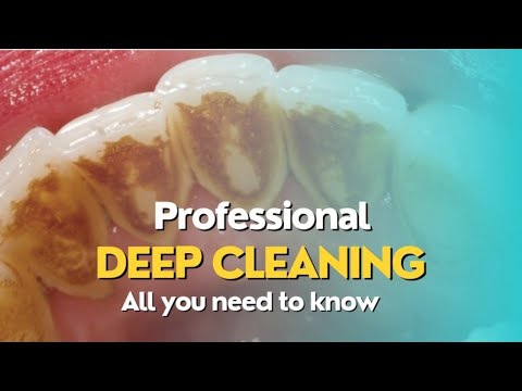3 Steps For A Deep Scaling And Professional Teeth Cleaning