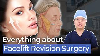 Answers to Every Question About Facelift Revision Surgery