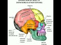 Lateral view of skull showing bones  Temporal frontal parietal occipital mandible maxilla zygomatic