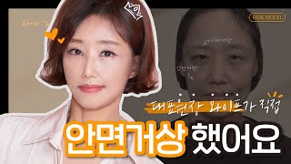 라봄성형외과 라봄성형외과